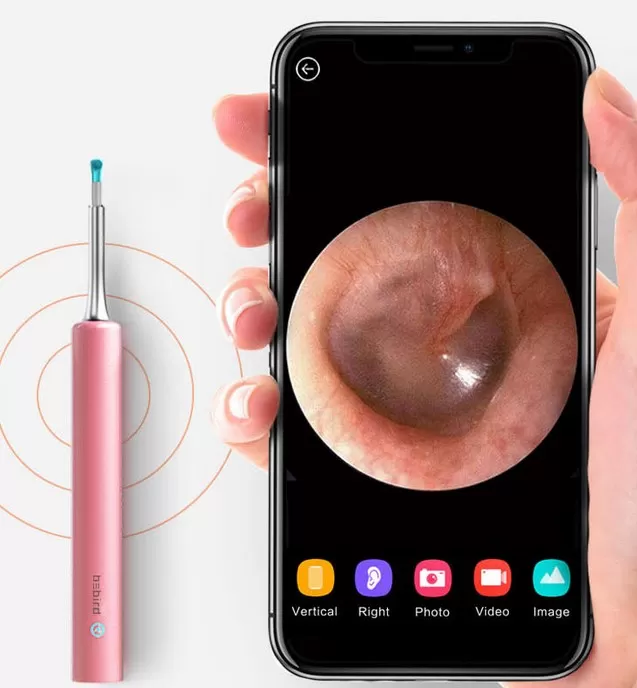 Картинка на экране телефона с умной ушной палочки Xiaomi Bebird Smart Visual Ear Stick T5